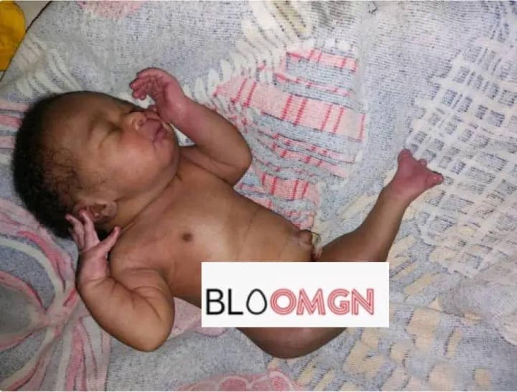 Faranah : Naissance d'un bébé avec malformation rare