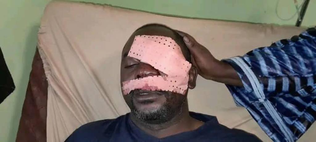 Conakry : le journaliste de la RTG Daouda Bah violemment agressé à Bonboly