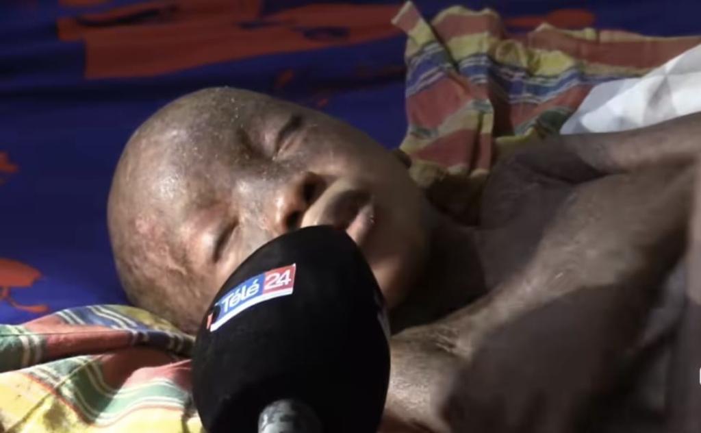 Mobilisation pour sauver la petite Anne Melissa Goumou : Un appel à la solidarité pour un enfant en détresse