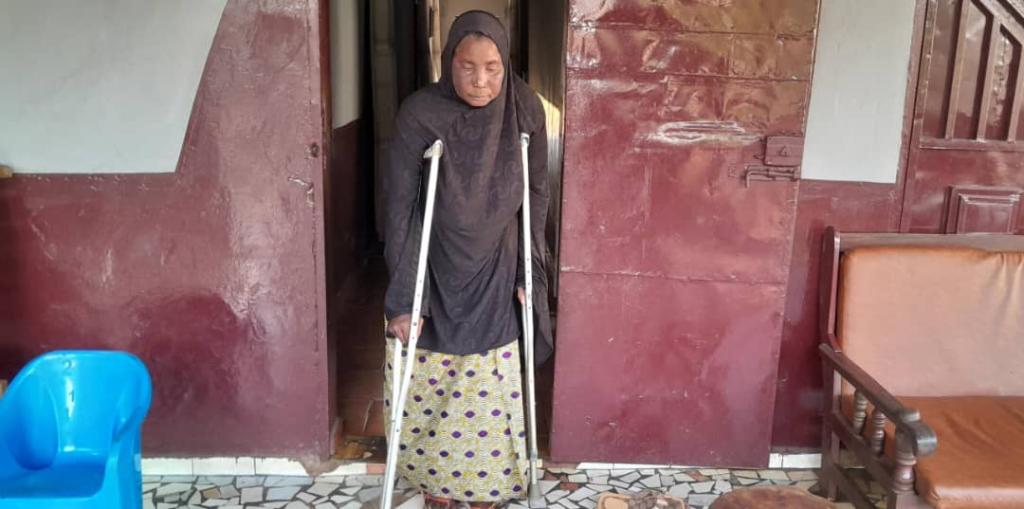 Victime d'un Accident de la Circulation : Fatoumata Kandou Lance un Appel à l'Aide pour une Opération de 50 Millions GNF